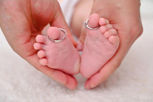 淄博怀孕妊娠线不明显